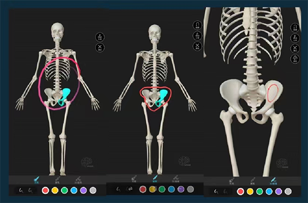 ʴʦѰ