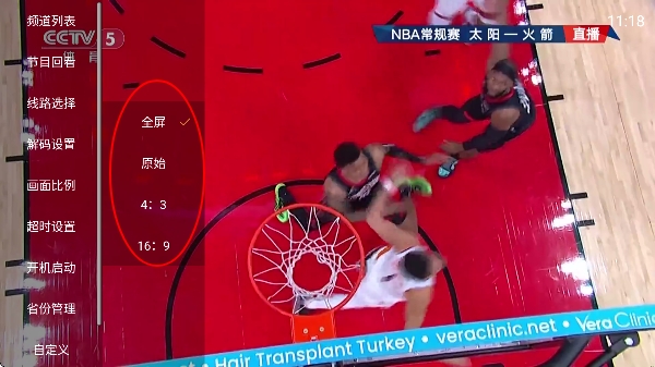 ���tvb����ֱ��