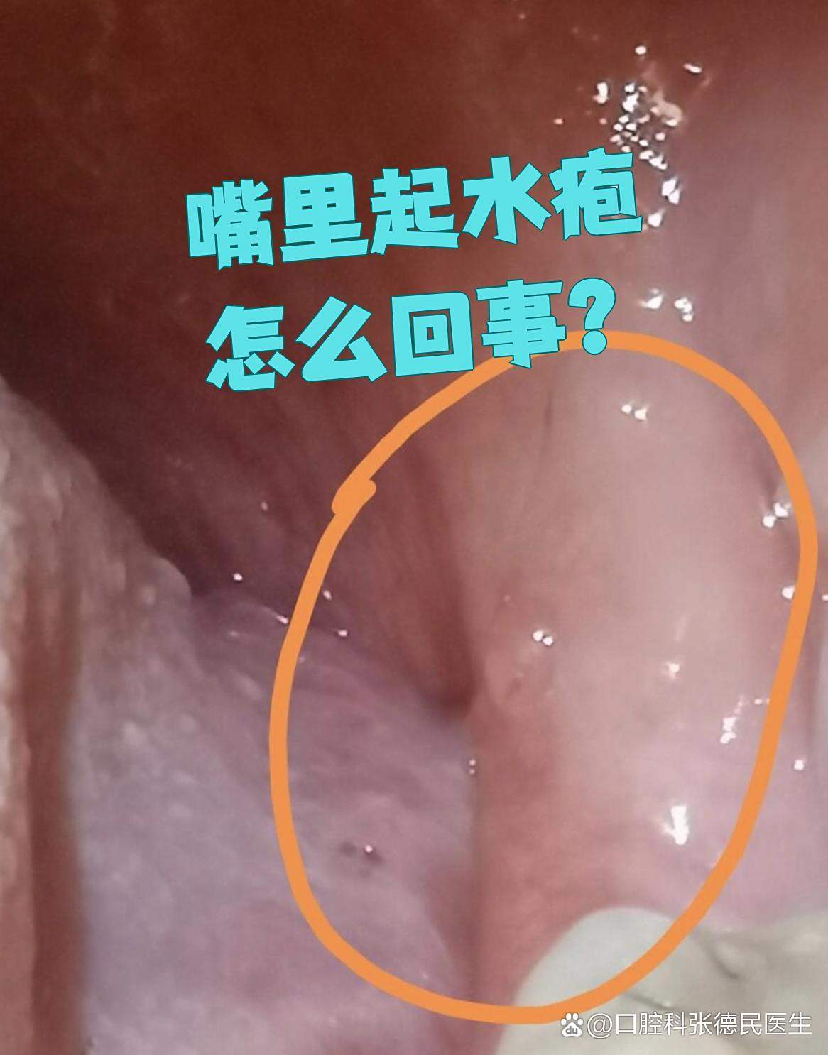 ������ ��׿�� �����ͼ
